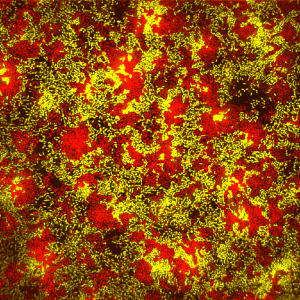 tapestry of biofilms